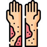 Dermatology